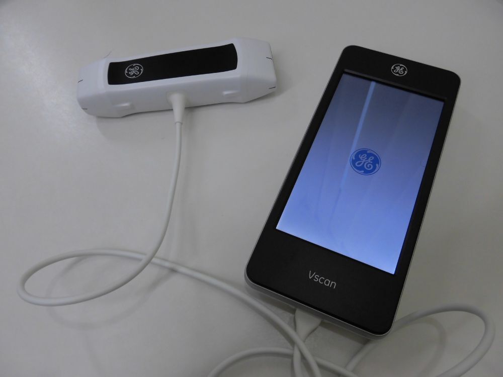 ポータブル超音波機器